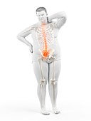 Obese man with back pain, illustration