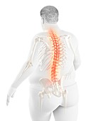 Obese man with back pain, illustration