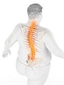 Obese man with back pain, illustration