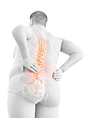 Obese man with back pain, illustration