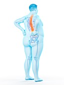 Obese man with back pain, illustration