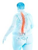 Obese man with back pain, illustration