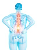 Obese man with back pain, illustration