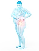 Obese man with hip pain, illustration