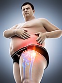 Obese man with hip pain, illustration