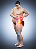 Obese man with hip pain, illustration