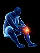 Obese man with knee pain, illustration