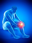 Obese man with knee pain, illustration