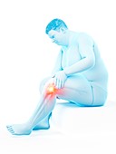 Obese man with knee pain, illustration