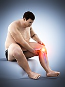 Obese man with knee pain, illustration