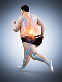 Obese runner with back pain, illustration