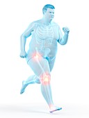 Obese runner with joint pain, illustration