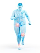 Obese runner with joint pain, illustration