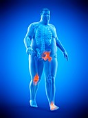 Obese runner with joint pain, illustration