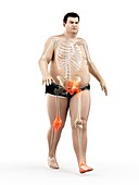 Obese runner with joint pain, illustration