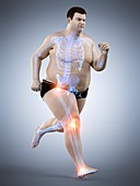 Obese runner with joint pain, illustration