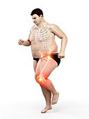 Obese runner with joint pain, illustration