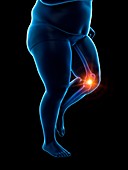 Obese runner with knee pain, illustration
