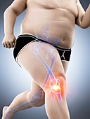 Obese runner with knee pain, illustration