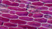 Plant cell plasmolysis, light microscopy