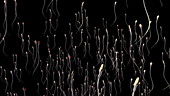 Sperm cells swimming