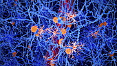 Microglia in Alzheimer's disease brain