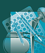 Medical implants, illustration