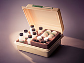 HIV testing kit, 1980s