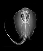 Ocellate river stingray, X-ray