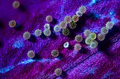 Hibiscus pollen grains, fluorescence light micrograph