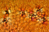Courgette (Cucurbita pepo) skin, light micrograph