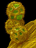 Dandelion pollen, SEM