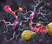 Research into multiple sclerosis, illustration