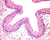 Ureter mucosa, light micrograph