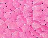 Cross-sectioned skeletal muscle fibres, light micrograph