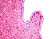 Urinary bladder mucosa, light micrograph