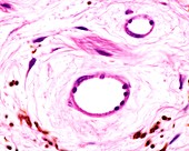 Blood vessels in iris stroma, light micrograph