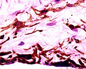Iris pigment cells, light micrograph