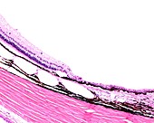 Border of retina and ciliary body, light micrograph