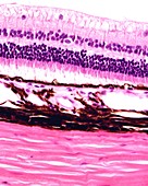 Retina and choroid, light micrograph