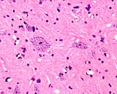 Nissl bodies in neuronal cell body, light micrograph
