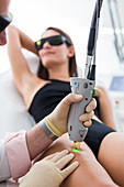 Permanent hair removal with laser