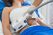CoolSculpting, cryolipolysis session