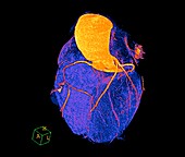 Normal heart, 3D CT scan