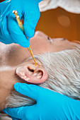 Ear acupuncture point therapy