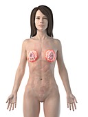 Inflamed mammary glands, conceptual illustration