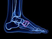 Medial cuneiform bone, illustration