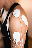 Physical therapy with TENS machine