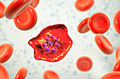 Plasmodium ovale inside red blood cell