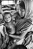 Smallpox in Bangladesh, 1970s